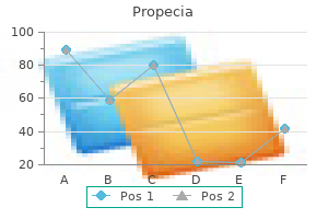 cheap propecia 1 mg without prescription