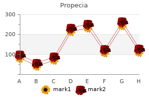 generic propecia 5mg