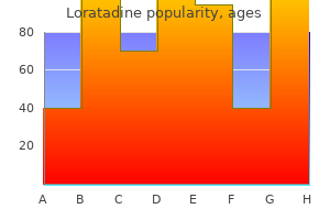 order loratadine 10mg amex