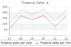 purchase finpecia 1mg online