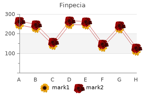 generic finpecia 1mg free shipping