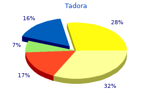 buy genuine tadora online