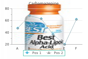 purchase 100mg carbamazepine with mastercard