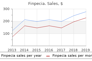 finpecia 1 mg low cost