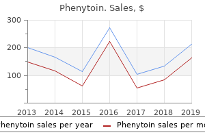 purchase 100 mg phenytoin mastercard