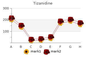 discount tizanidine 2 mg fast delivery